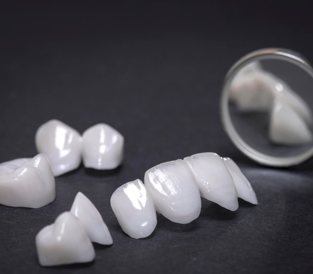 carillas-ceramica-clinica-dental-barcelona-